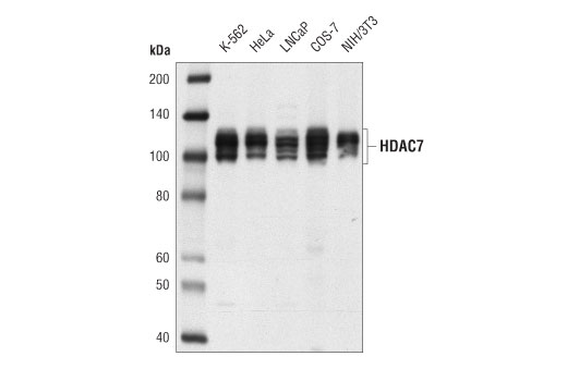  Image 3: Class II HDAC Antibody Sampler Kit