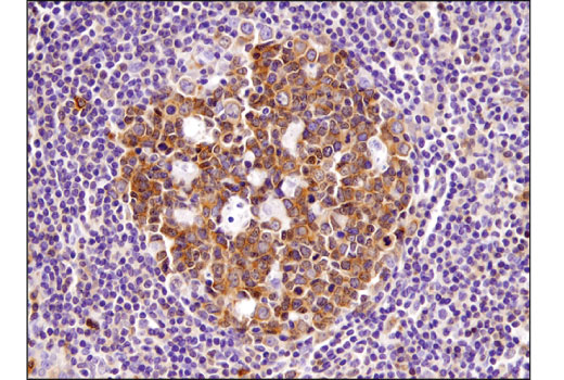 Immunohistochemistry Image 4: HDAC7 (D4E1L) Rabbit mAb