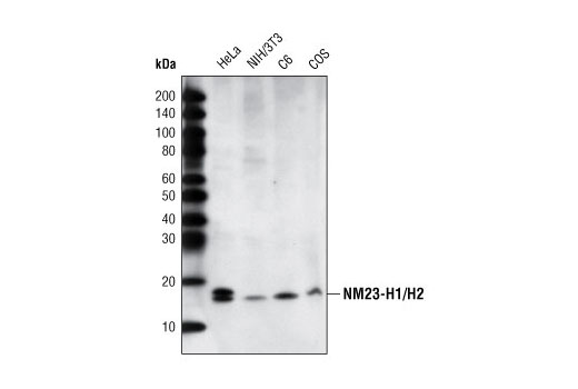 Western Blotting Image 1: NME1/NDKA (D98) Antibody