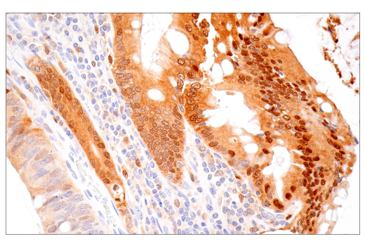Immunohistochemistry Image 2: IL-18 (E3G8R) Rabbit mAb (BSA and Azide Free)