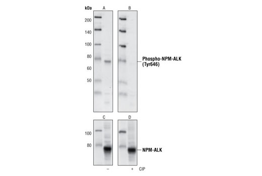  Image 5: ALK Antibody Sampler Kit