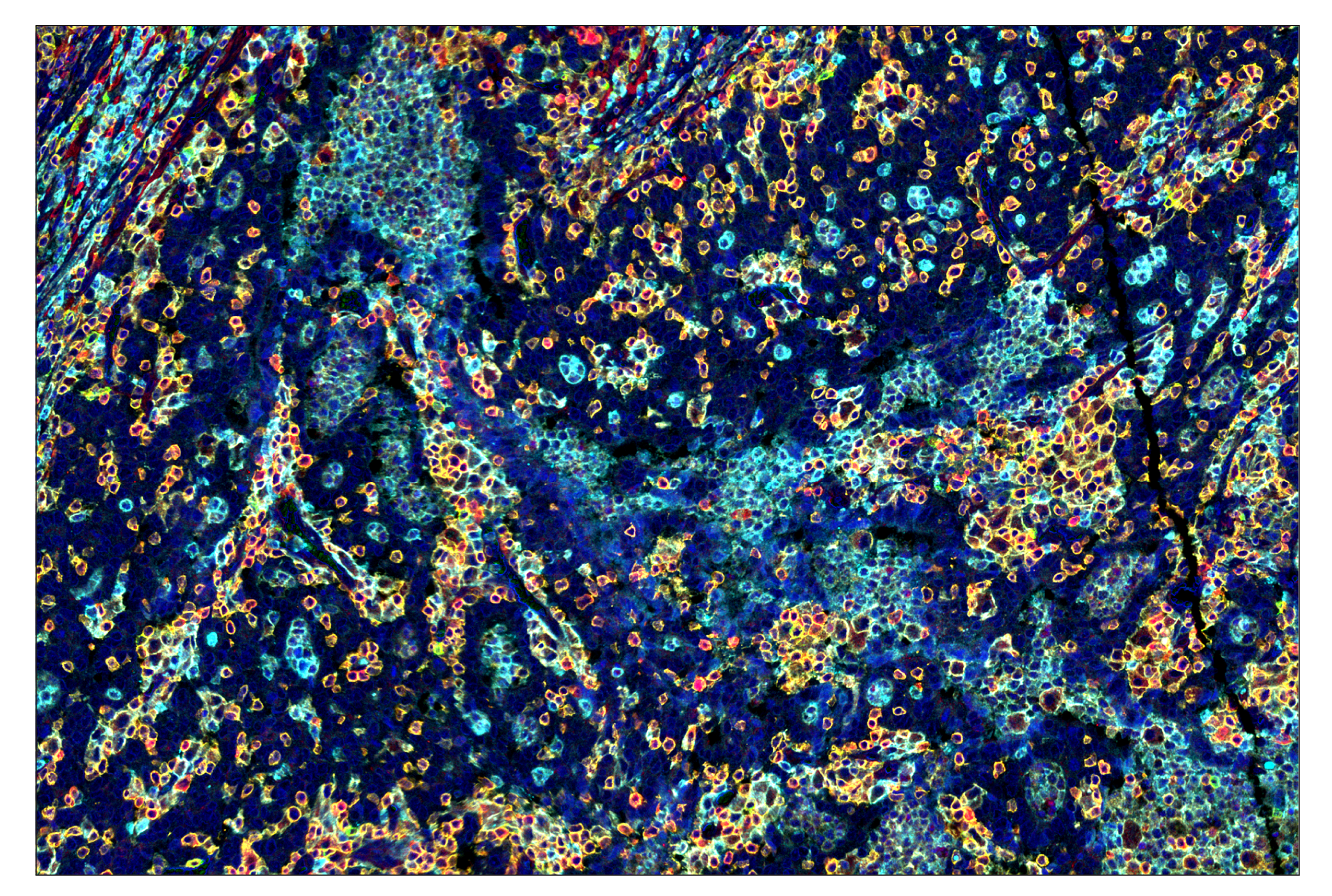 Immunohistochemistry Image 1: CD45 (Intracellular Domain) (D9M8I) & CO-0013-647 SignalStar™ Oligo-Antibody Pair