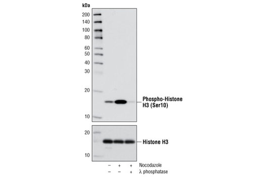  Image 1: PhosphoPlus® Histone H3 (Ser10) Antibody Duet