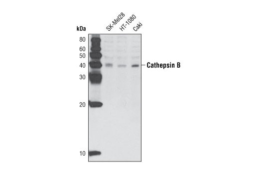 Western Blotting Image 1: Cathepsin B (H190) Antibody