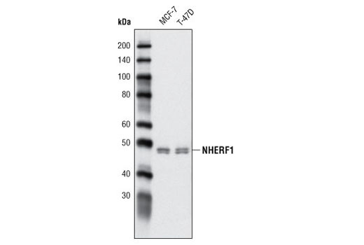 Western Blotting Image 1: NHERF1 (A310) Antibody