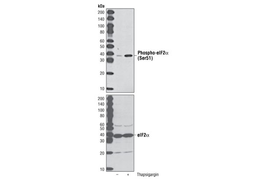  Image 2: PhosphoPlus® eIF2α (Ser51) Antibody Duet