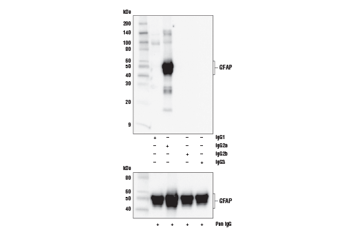  Image 16: β-Amyloid Mouse Model Neuronal Viability IF Antibody Sampler Kit