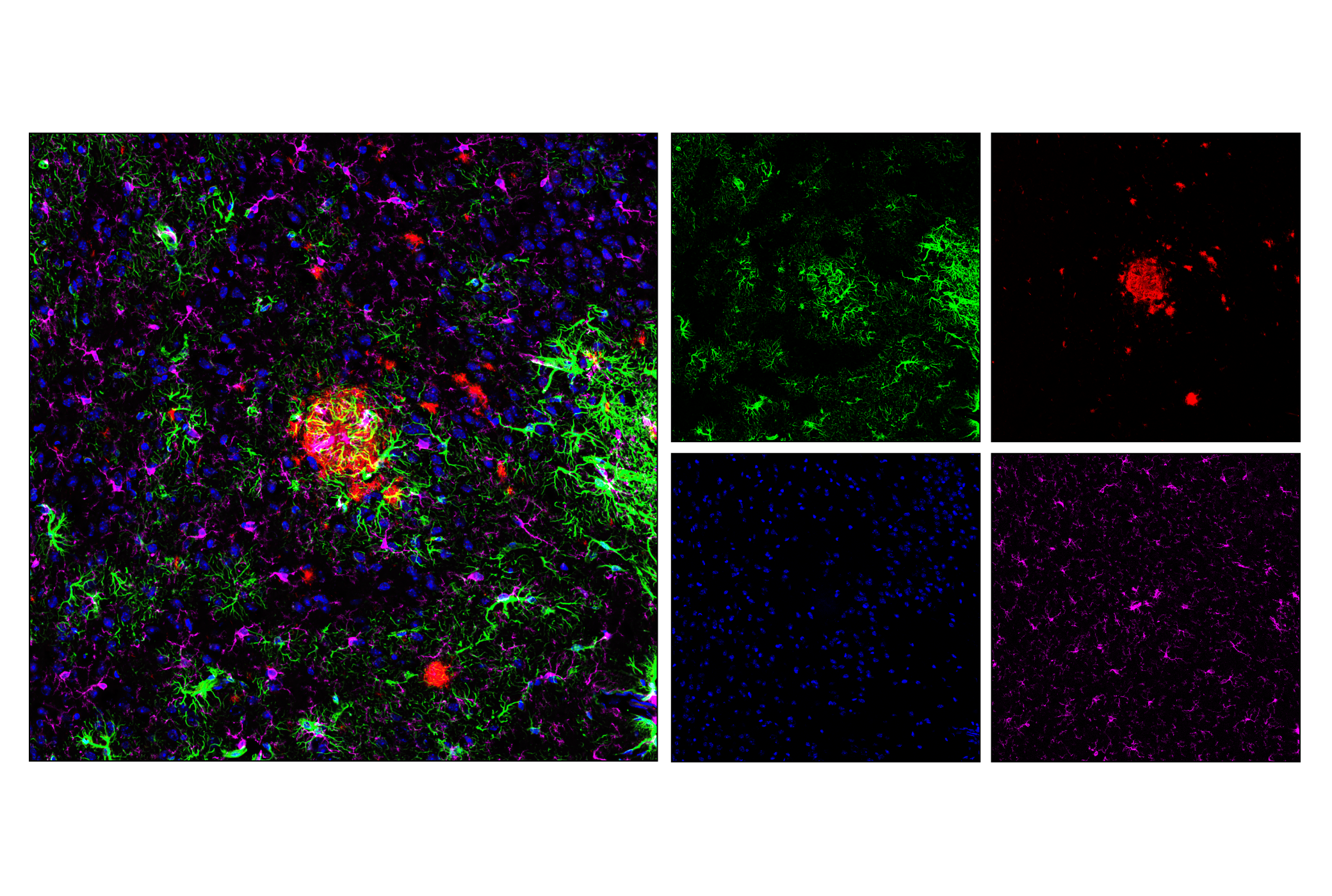 Immunofluorescence Image 1: GFAP (E6N9L) Mouse mAb