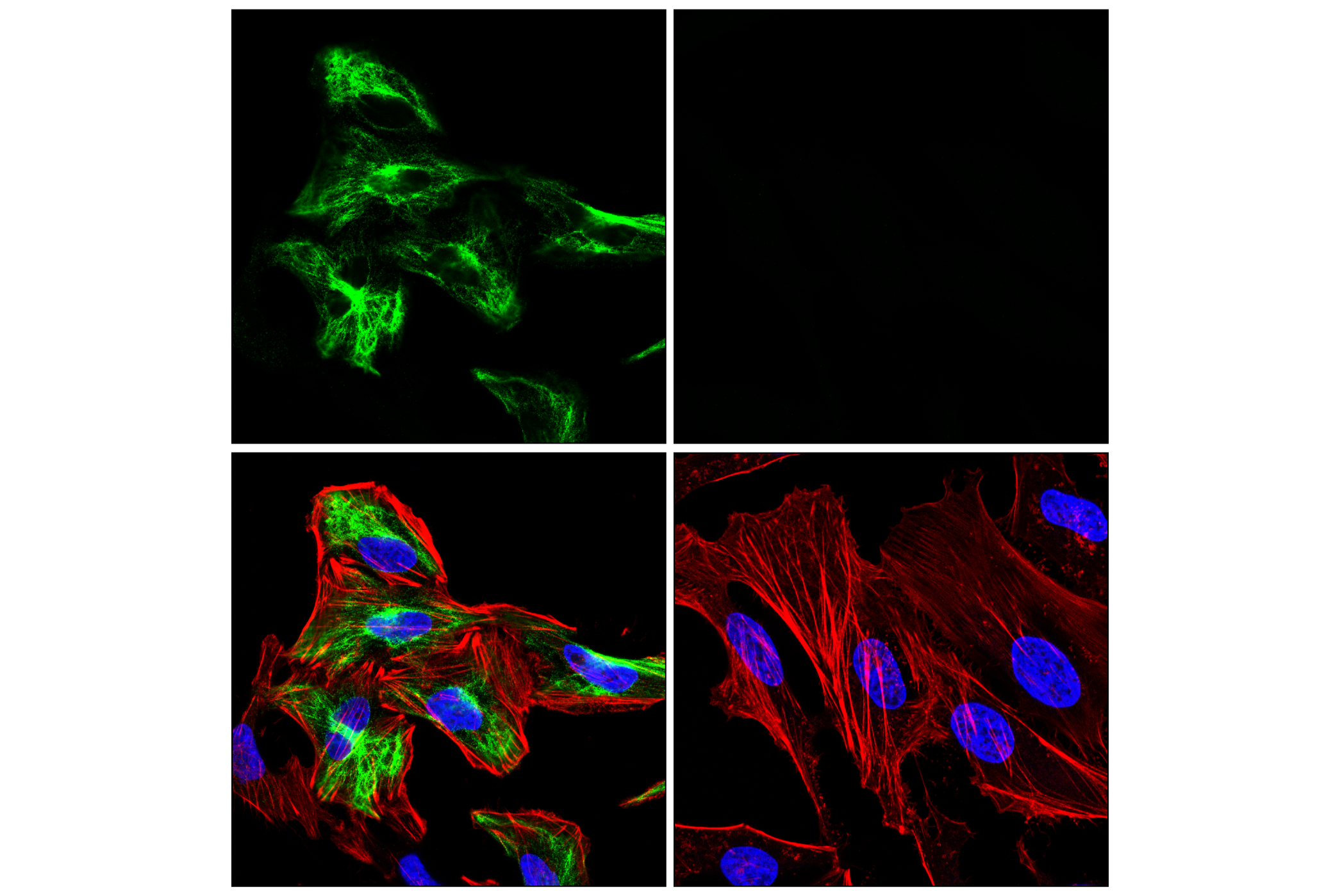  Image 38: β-Amyloid Mouse Model Neuronal Viability IF Antibody Sampler Kit