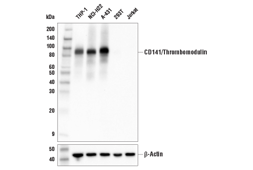 Western Blotting Image 1: CD141/Thrombomodulin (E7Y9P) XP® Rabbit mAb (BSA and Azide Free)