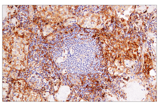 Immunohistochemistry Image 4: CD141/Thrombomodulin (E7Y9P) XP® Rabbit mAb (BSA and Azide Free)
