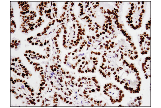 Immunohistochemistry Image 1: Acetyl-Histone H2B (Lys20) (D7O9W) Rabbit mAb