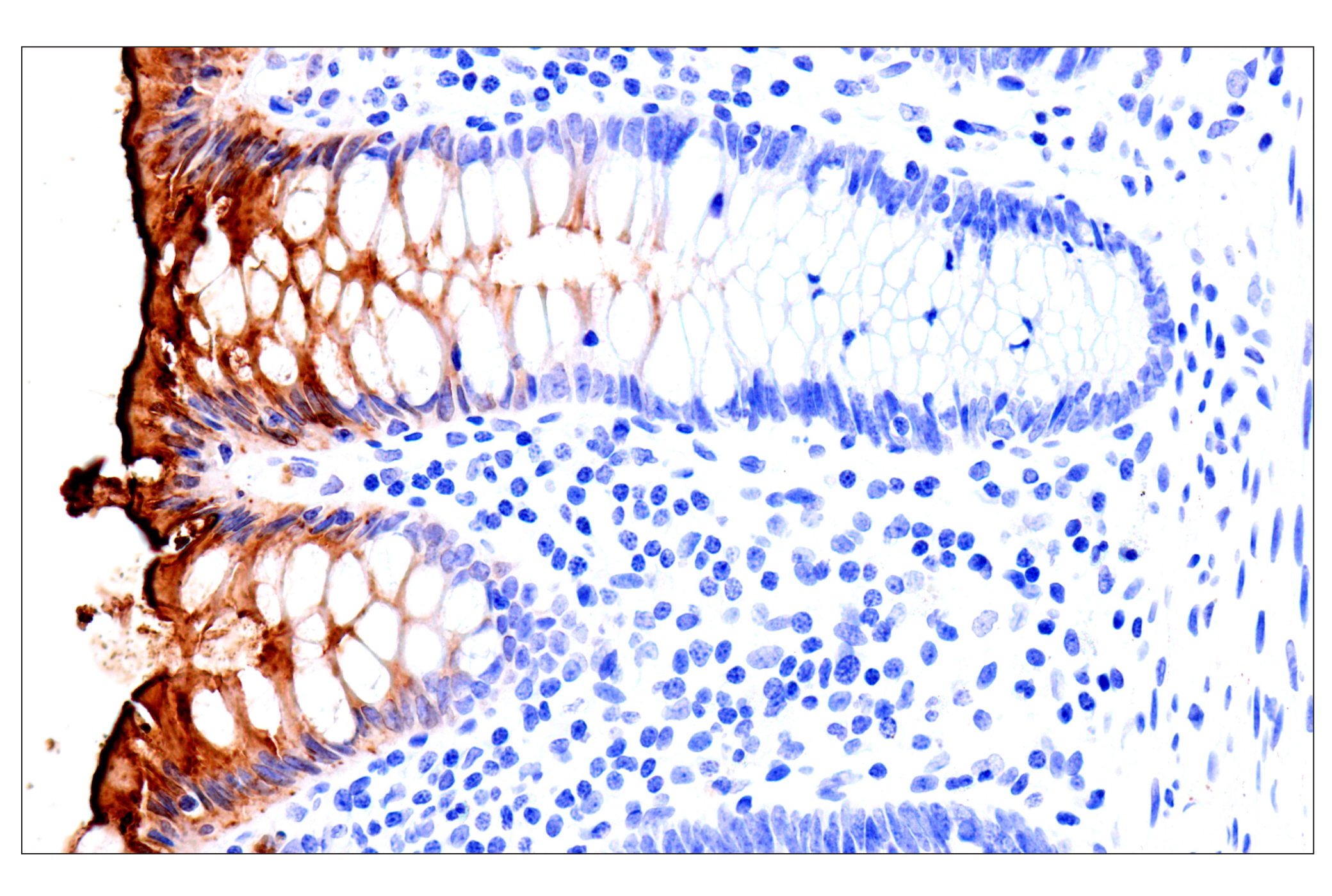Immunohistochemistry Image 9: CEACAM7 (E5Q6X) Rabbit mAb (BSA and Azide Free)