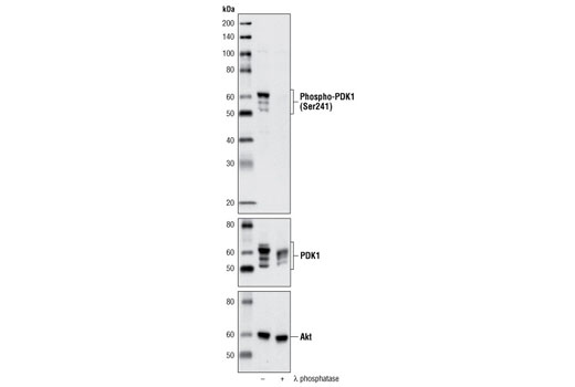  Image 8: PTEN and PDK1 Antibody Sampler Kit II