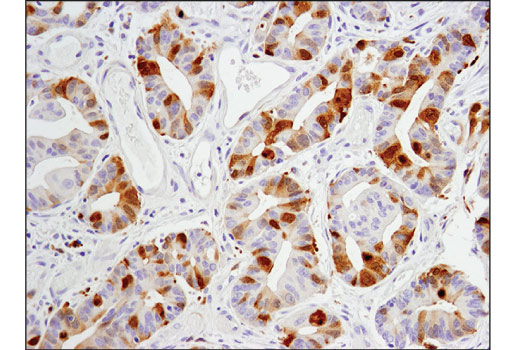 Immunohistochemistry Image 1: Aurora A (D3V7T) XP® Rabbit mAb (BSA and Azide Free)