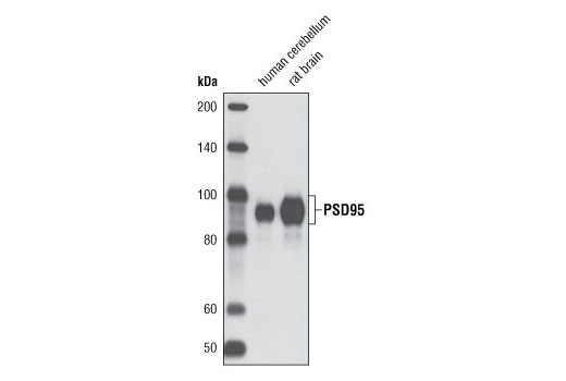  Image 3: PhosphoPlus® PSD95 (Ser295) Antibody Duet