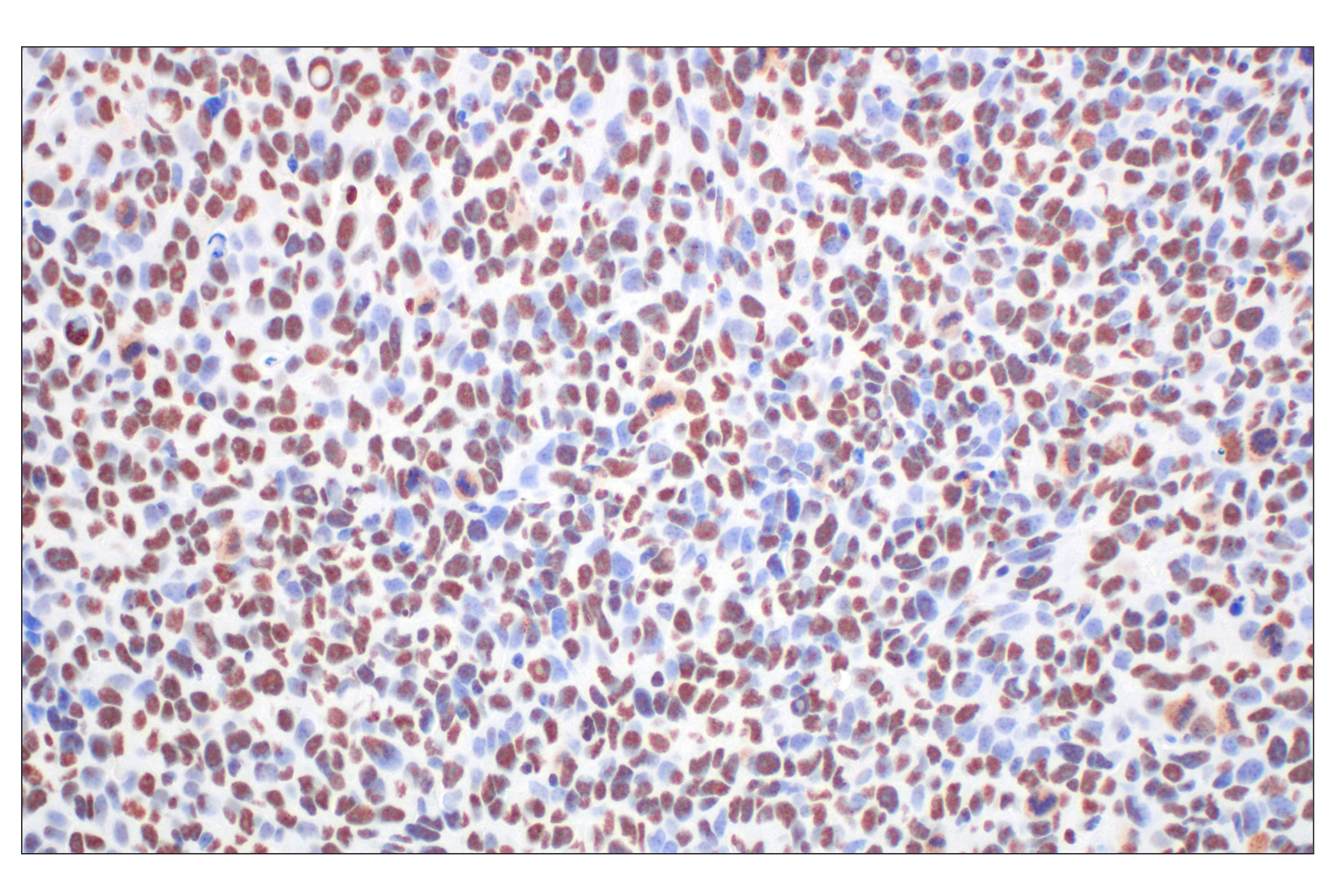 Immunohistochemistry Image 9: CBX7 (E7N1W) Rabbit mAb