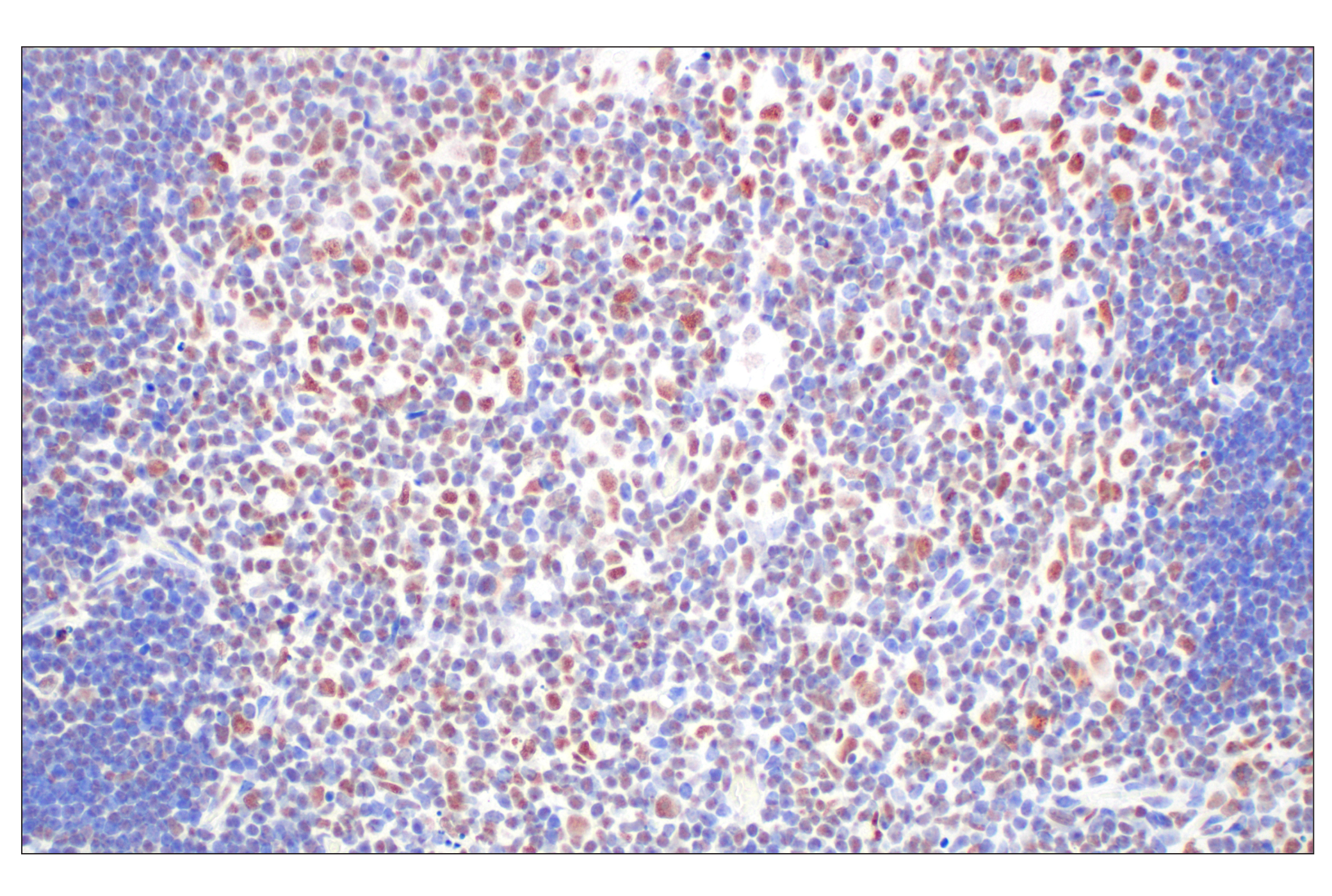 Immunohistochemistry Image 12: CBX7 (E7N1W) Rabbit mAb