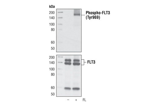  Image 2: Phospho-FLT3 Antibody Sampler Kit