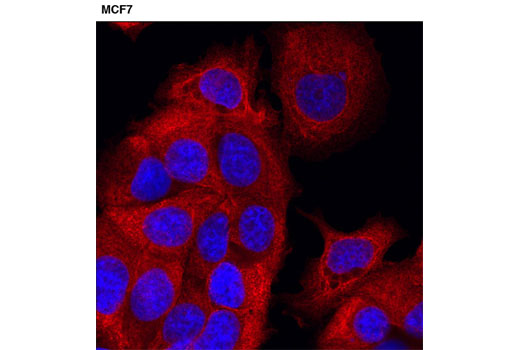 Immunofluorescence Image 3: Pan-Keratin (C11) Mouse mAb (Alexa Fluor® 555 Conjugate)
