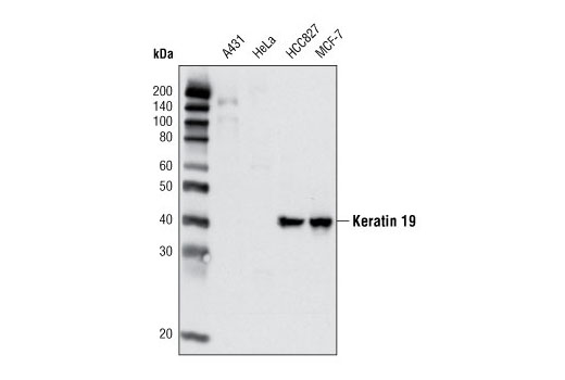 Western Blotting Image 1: Keratin 19 Antibody