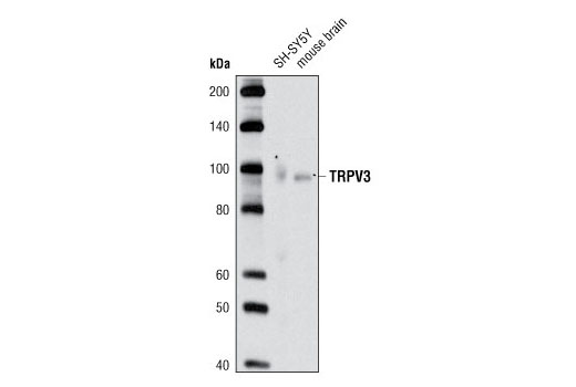 Western Blotting Image 1: TRPV3 Antibody