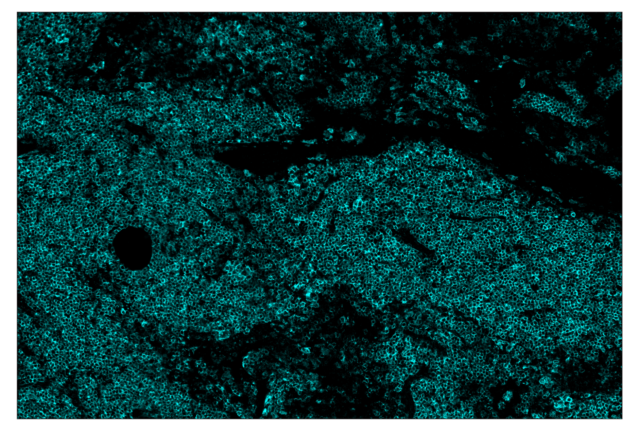 Immunohistochemistry Image 4: CD19 (Intracellular Domain) (D4V4B) & CO-0054-594 SignalStar™ Oligo-Antibody Pair