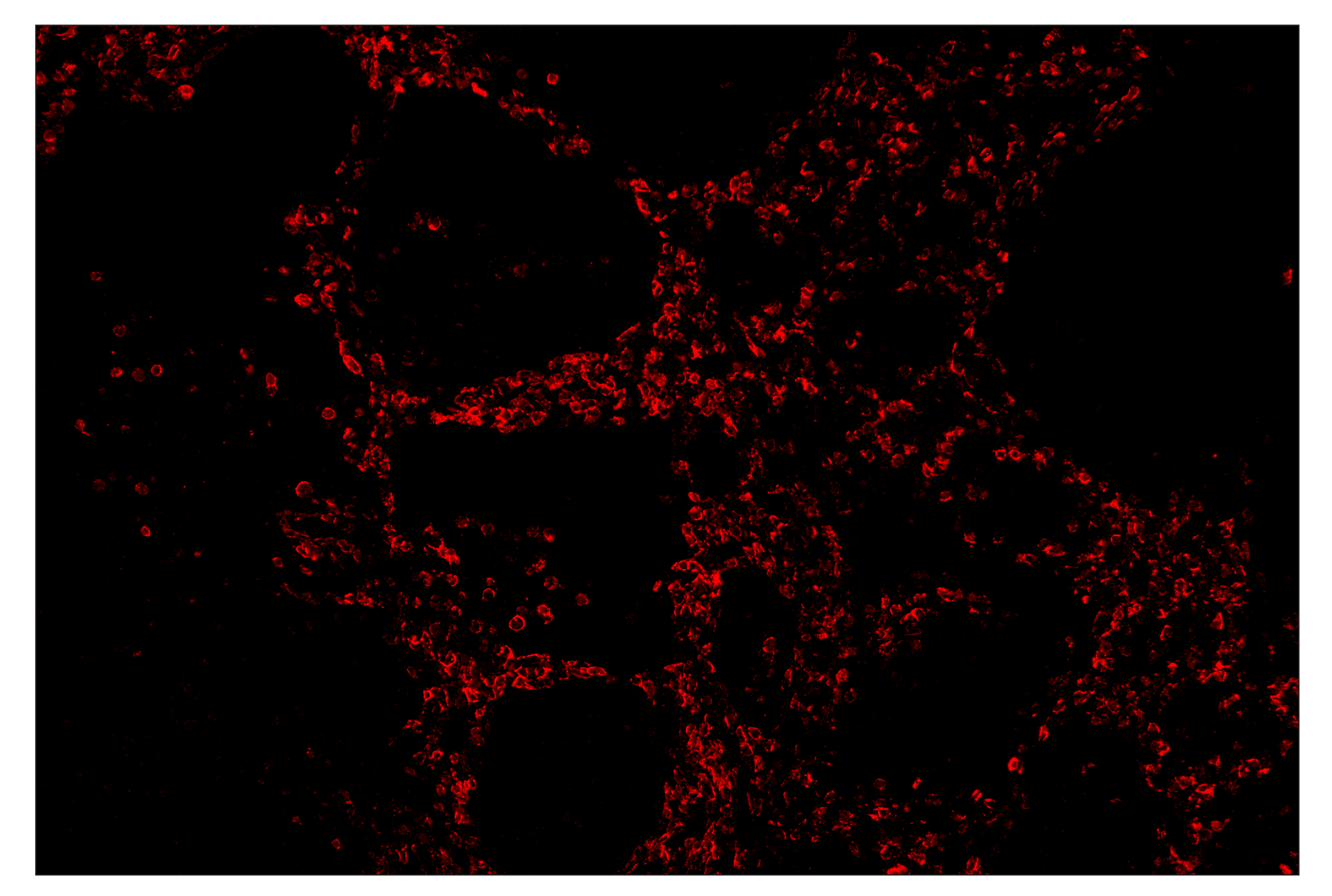 Immunohistochemistry Image 3: CD19 (Intracellular Domain) (D4V4B) & CO-0054-750 SignalStar™ Oligo-Antibody Pair