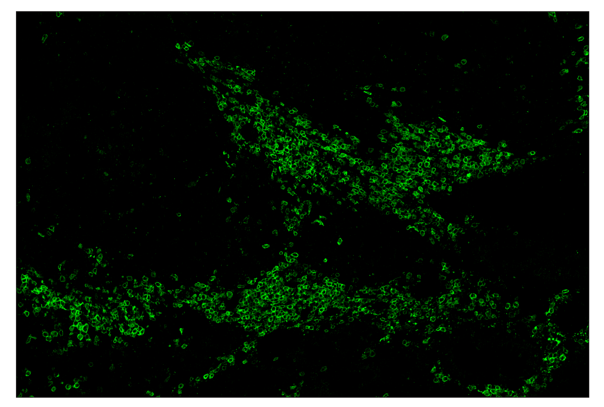 Immunohistochemistry Image 1: CD19 (Intracellular Domain) (D4V4B) & CO-0054-594 SignalStar™ Oligo-Antibody Pair