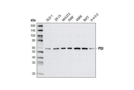  Image 6: ER and Golgi-Associated Marker Proteins Antibody Sampler Kit