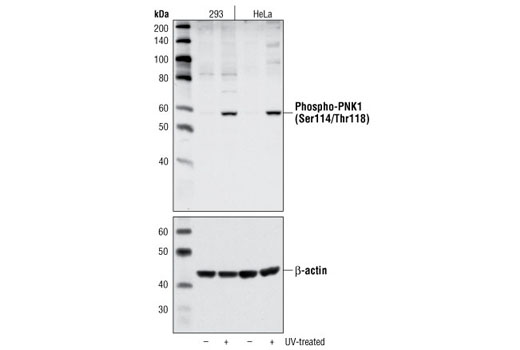 Western Blotting Image 1: Phospho-PNK1 (Ser114/Thr118) Antibody