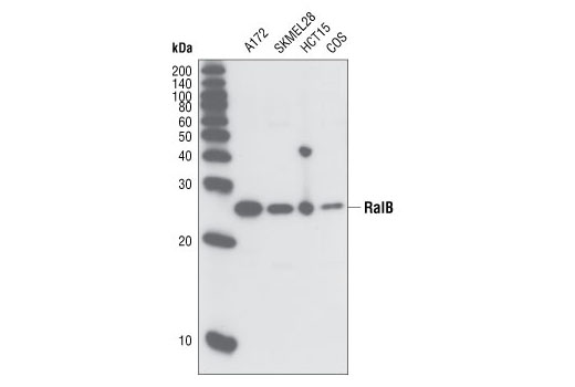 Western Blotting Image 1: RalB Antibody