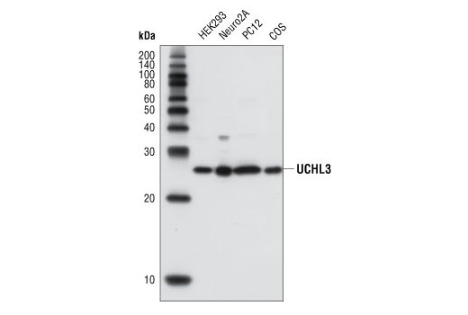 Western Blotting Image 1: UCHL3 Antibody
