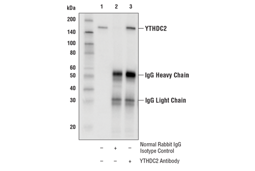 Immunoprecipitation Image 1: YTHDC2 Antibody