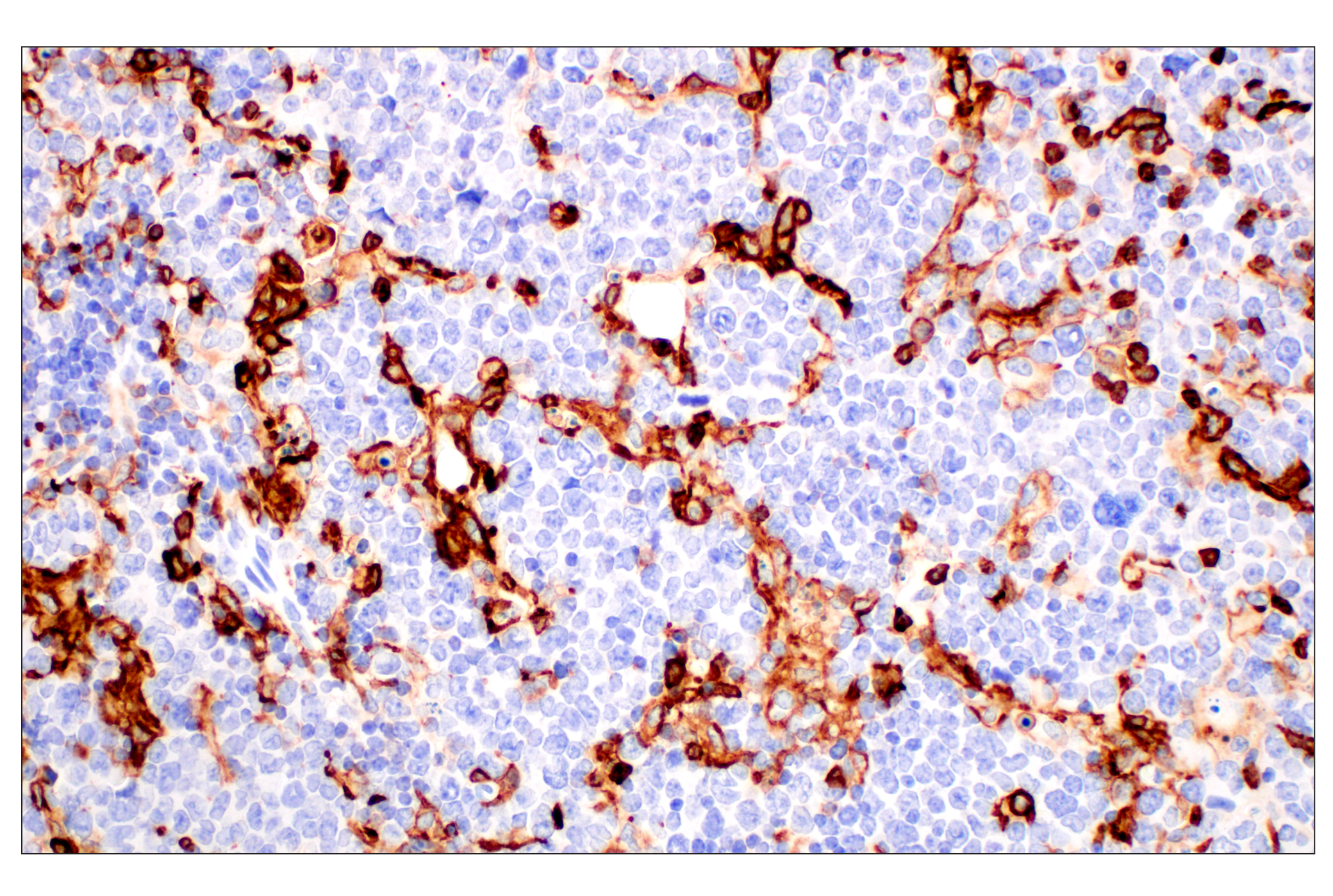Immunohistochemistry Image 1: CD11b/ITGAM (E4K8C) Rabbit mAb (BSA and Azide Free)