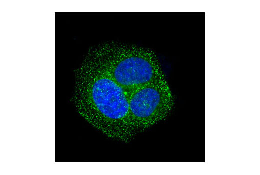Immunofluorescence Image 1: Rab5 (C8B1) Rabbit mAb