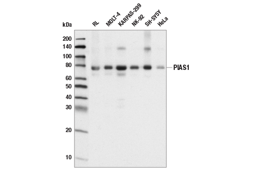  Image 3: Jak/Stat Pathway Inhibitors Antibody Sampler Kit