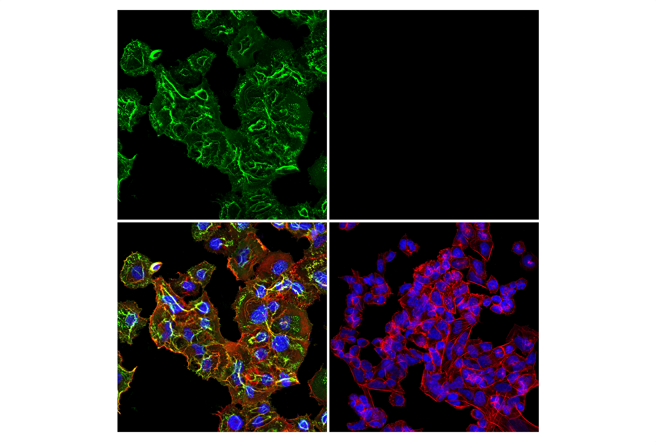  Image 33: Wnt/β-Catenin Activated Targets Antibody Sampler Kit