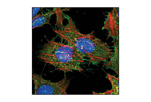 Image 40: Wnt/β-Catenin Activated Targets Antibody Sampler Kit