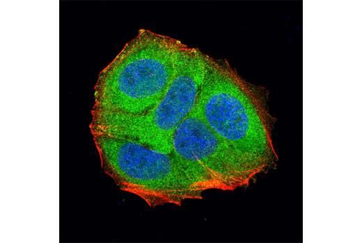 Immunofluorescence Image 1: LDHA (C4B5) Rabbit mAb