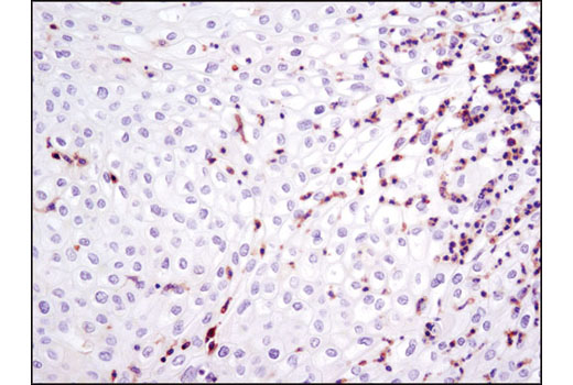 Immunohistochemistry Image 1: LCP1 (D1C3) Rabbit mAb