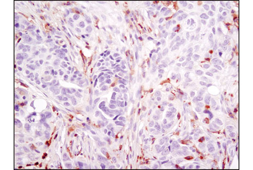 Immunohistochemistry Image 3: LCP1 (D1C3) Rabbit mAb