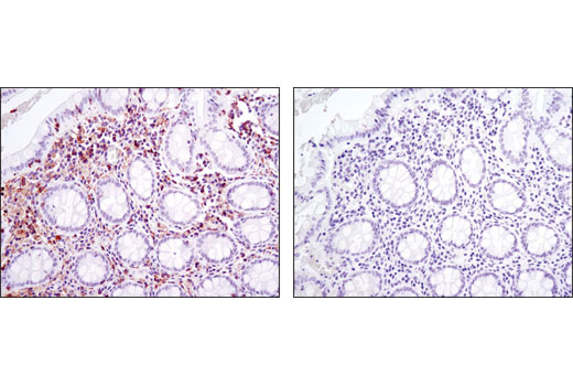 Immunohistochemistry Image 4: LCP1 (D1C3) Rabbit mAb