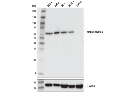 Western Blotting Image 1: Malic Enzyme 2 (E1N3F) XP® Rabbit mAb