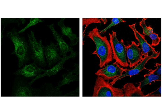 Immunofluorescence Image 2: Nicastrin (D4F6N) Rabbit mAb (BSA and Azide Free)