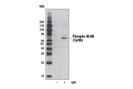  Image 6: B Cell Signaling Antibody Sampler Kit