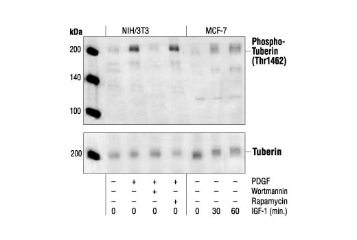 Western Blotting Image 1: Phospho-Tuberin/TSC2 (Thr1462) Antibody