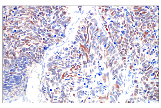 Immunohistochemistry Image 1: POU2F3 (E5N2D) XP® Rabbit mAb