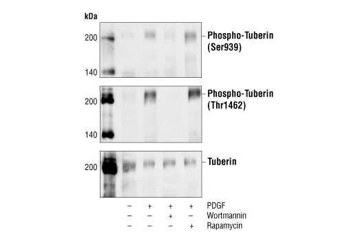  Image 2: Phospho-TSC2 Antibody Sampler Kit