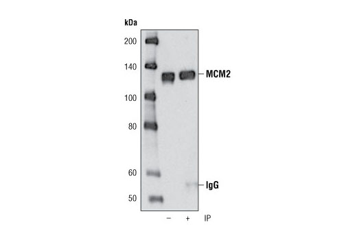 Immunoprecipitation Image 1: MCM2 (D7G11) XP® Rabbit mAb